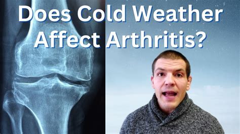 Does Cold Weather Affect Arthritis 5 Tips To Ease Arthritis Pain From Cold Weather Youtube