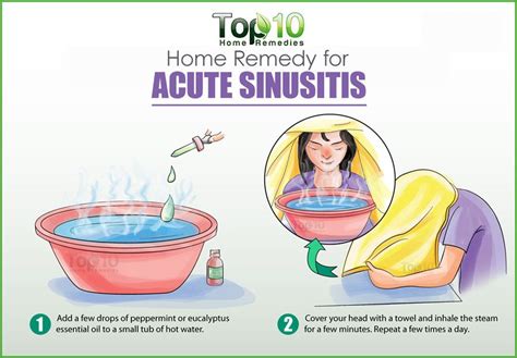 Acute Sinusitis Home Remedies For Relief Top 10 Home Remedies