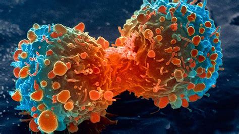 Designer Virus Helps The Body Fight Back Against Cancer Evolving Science