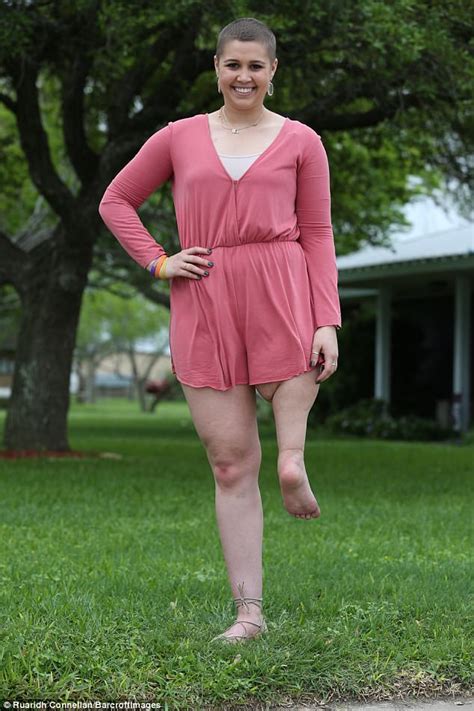 Miss Teen Contestant Has Her Knee Replaced With An Ankle Daily Mail