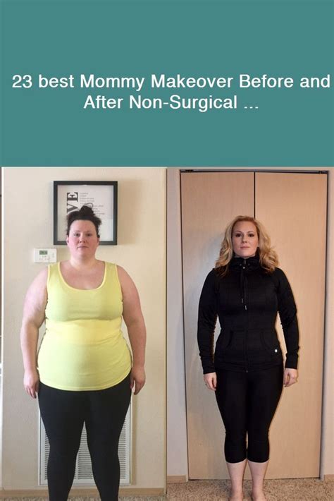 surgical weight loss programs
