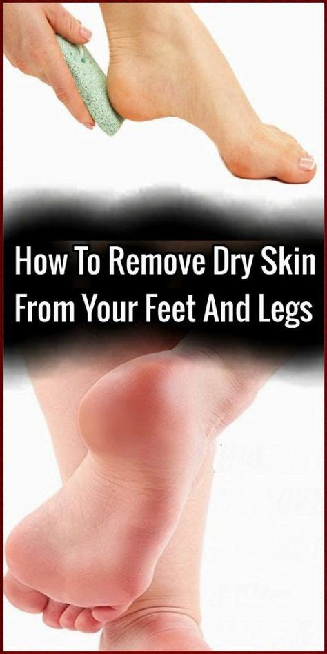 How To Remove Dry Skin From Your Feet And Legs Skin Name In 2019