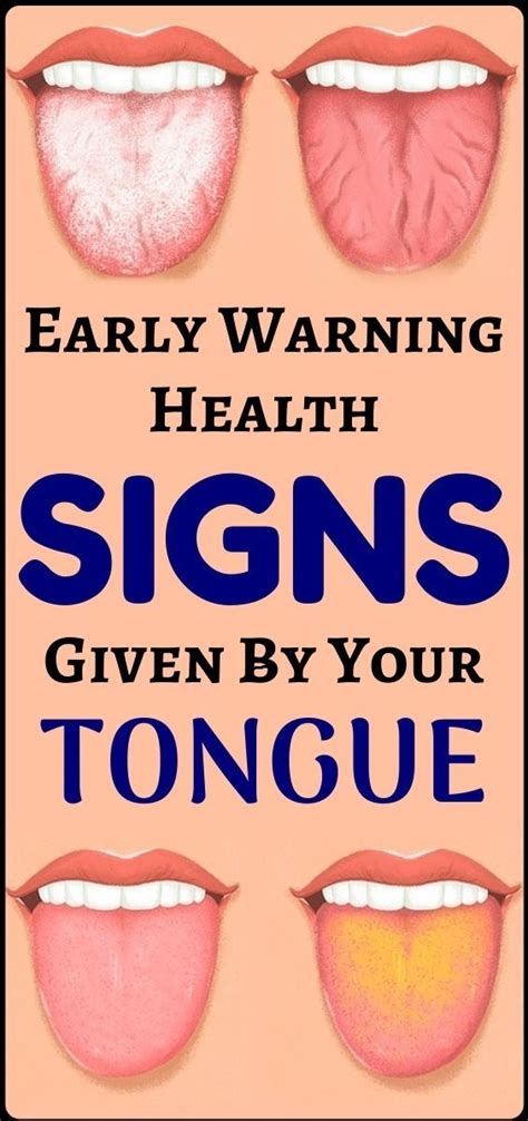 What Your Tongue Says About Your Health Wellness Rise