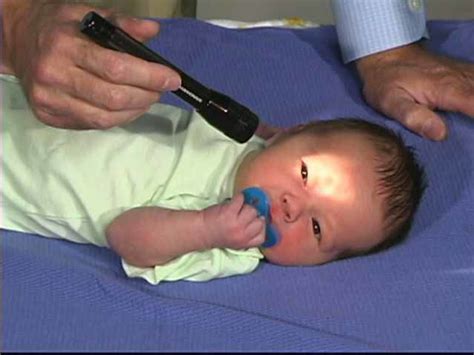 Neurologic Exam Pediatric Newborn Normal Behavior