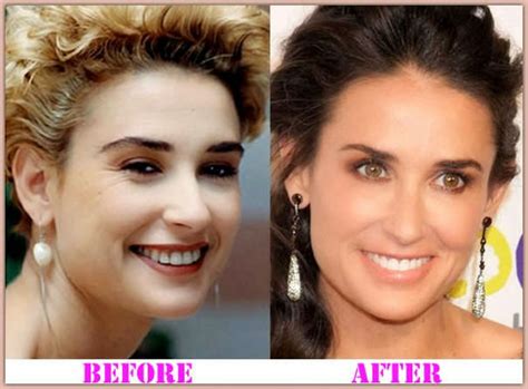 Chatter Busy: Demi Moore Plastic Surgery