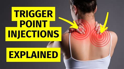 Myofascial Pain Trigger Point Injections Explained Youtube
