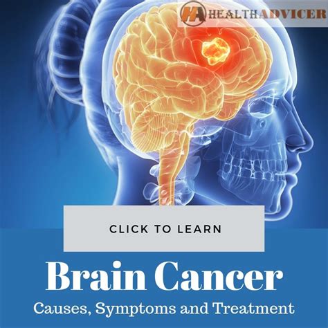 Brain Cancer Causes Picture Symptoms And Treatment