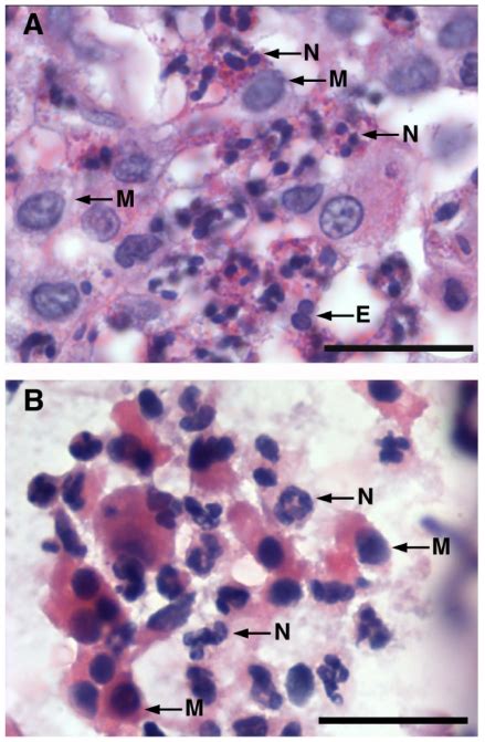 Representative High Magnification Photomicrographs Mag ×1000