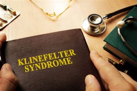 Famous People With Klinefelter Syndrome Stdgov Blog