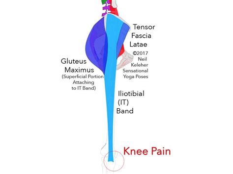 It Band Knee Pain