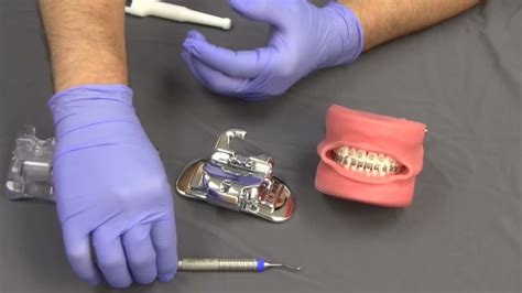 American Orthodontics Empower Self Ligating Braces Opening And Closing