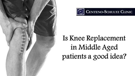 Why Are Middle Age People Getting Knee Replacements Stem Cell Blog