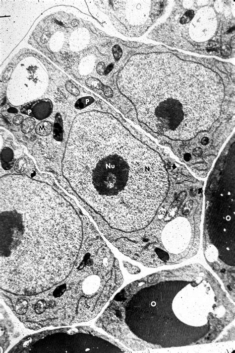 Label Electron Micrograph Plant Cells