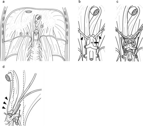 The Anatomy Around The Median Arcuate Ligament A The Anatomy Of The