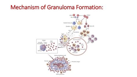 The Formation And Function Of Granuloma