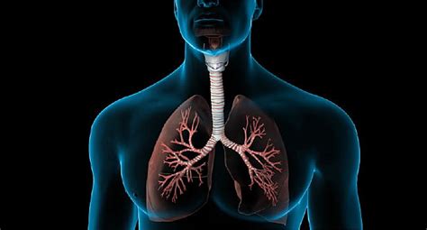 Ce Este Embolia Pulmonar Ziarmedical Ro