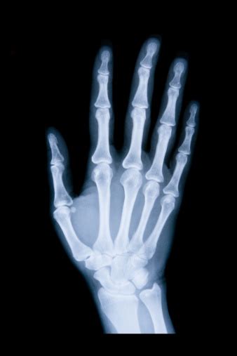Right Hand Xray Xxl Stock Photo Download Image Now Right Handed X