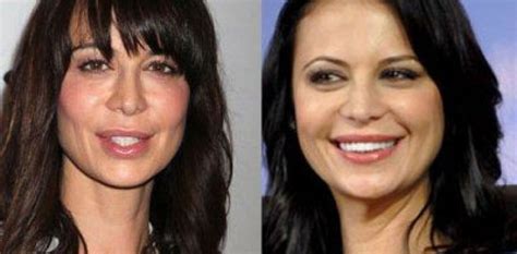 Catherine Bell Plastic Surgery Before And After Face Photos