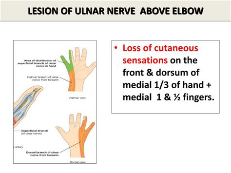 Ppt Median And Ulnar Nerves Powerpoint Presentation Free Download Id