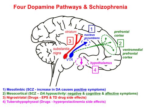 조현병 쉽게설명 병리기전 도파민 항정신병약제schizophrenia Dopamine Theory