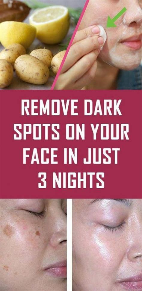 How To Take Away Brown Spots On Face Brownsunspotsonface Remove Dark