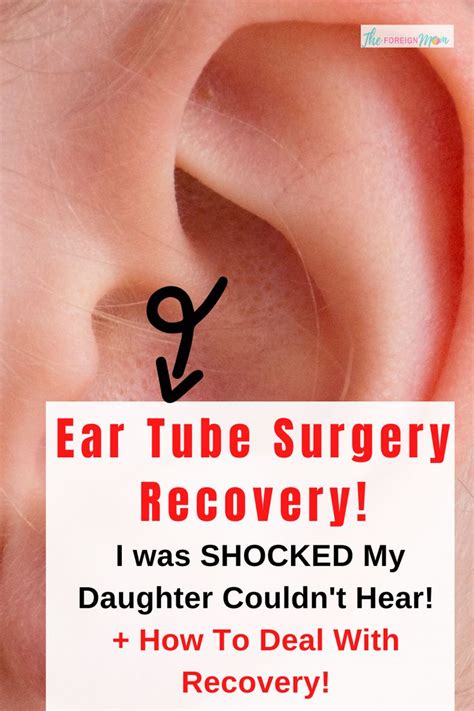 Ear Tube Surgery Recovery