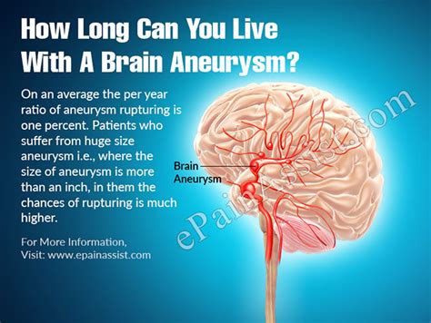 More, though, was the comfort of knowing exactly how to proceed when she was deep in a coma. How Long Can You Live With A Brain Aneurysm?