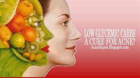 Low Glycemic Carbs A Cure For Acne Youtube