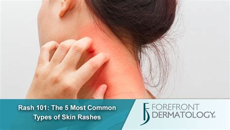 Rash 101 The 5 Most Common Types Of Skin Rashes Dermspecialists
