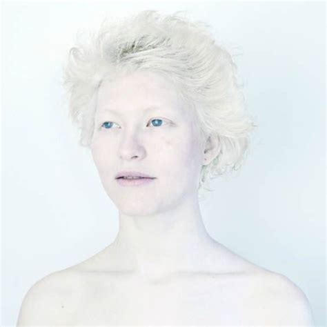 Snow White Haunting Photographic Of People With Albinism Art