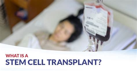 Stem Cell Transplant CFCH Centre For Clinical Haematology
