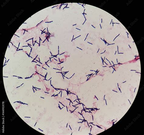 Smear Of Human Blood Culture Gram S Stained With Gram Positive Bacilli