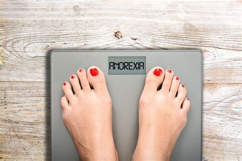 Anorexia Text On Weight Scale Eating Disorder As Serious Mental Illness