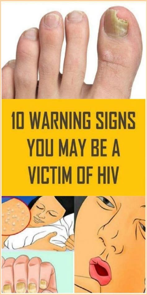 10 Warning Signs You May Be A Victim Of Hiv Healthy Low