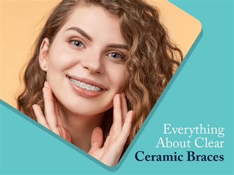 Everything To Know About Clear Ceramic Braces