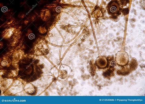 Characteristics Of Rhizopus Is A Genus Of Common Saprophytic Fungi On