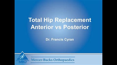 Anterior Vs Posterior Total Hip Replacements Pros And Cons For The Patient Youtube