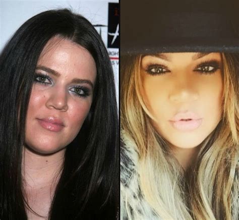 I never used photoshop but if i was khloe kardashian, i would have remembered to photoshop the rest of the necklace. Khloe Kardashian before and after plastic surgery 02 ...