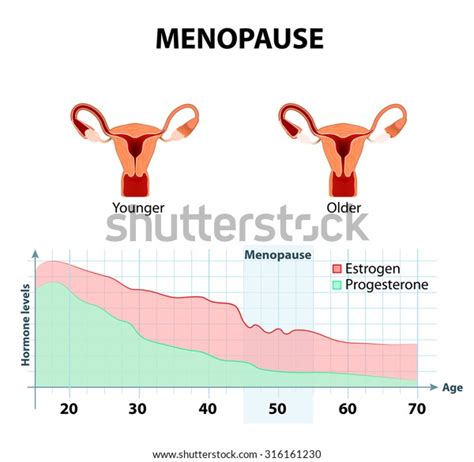 Fluctuation Hormones That Occurs During Menopause Stock Vector Royalty