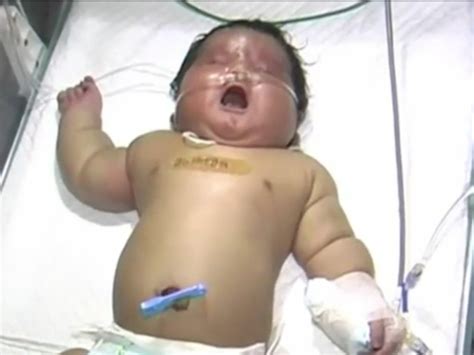 Inde : Une femme de 36 ans donne naissance au plus gros bébé du monde