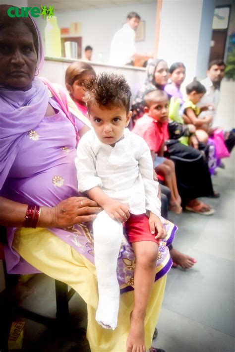 #clubfoot | 12.1m personen haben sich das angeschaut. CURE Int'l India on Twitter: "Determined to fight clubfoot ...