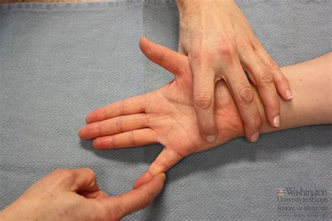 Flexor Digiti Minimi