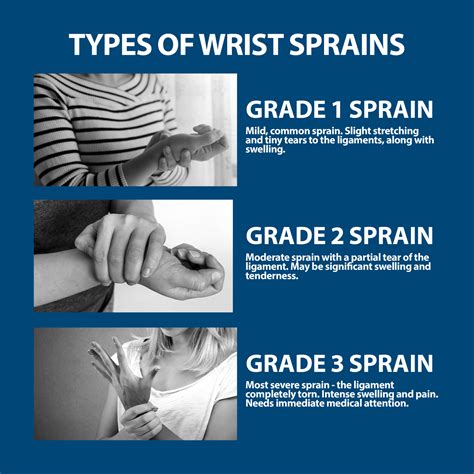 Sprained Wrist Symptoms Florida Orthopaedic Institute