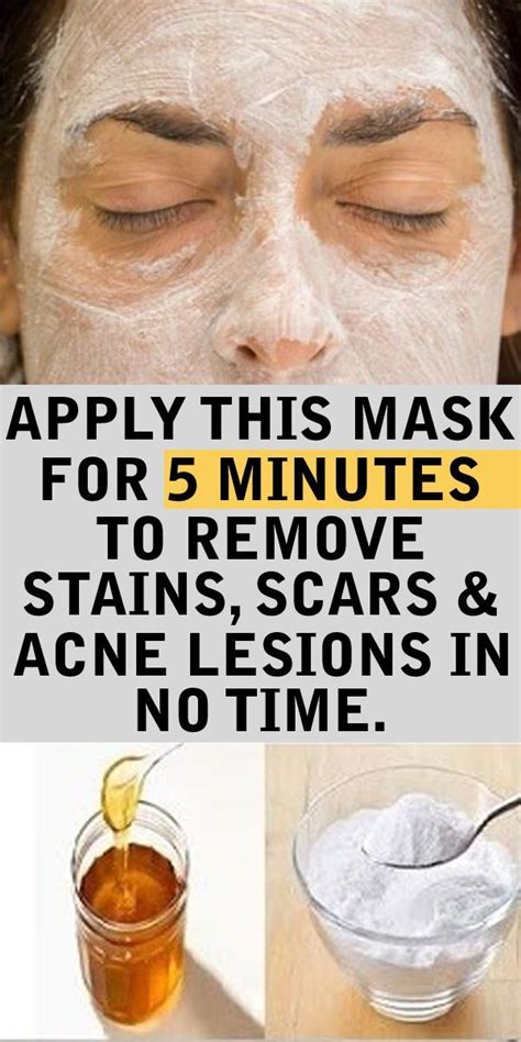 Apply This Baking Soda And Honey Mask On Your Face And See What Will