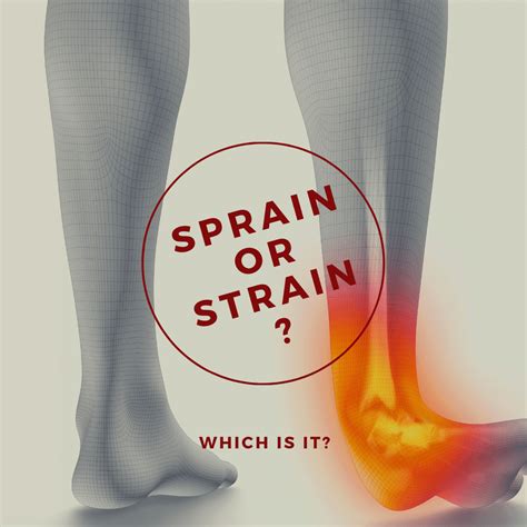 Sprain Or Strain Which Is It Md First Primary And Urgent Care