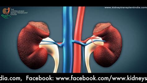 Kidney Transplantation Animation Of Surgical Steps As Performed By Dr