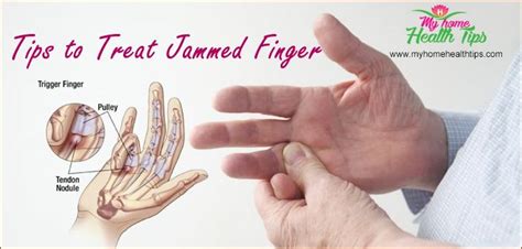 A Jammed Finger Is One Of The Common Problems That Are Seen In Most Of