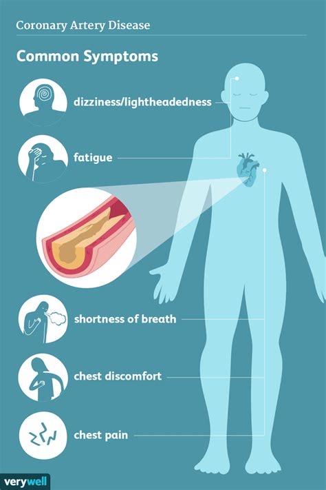 Maladie Des Artères Coronaires Signes Symptômes Et Complications