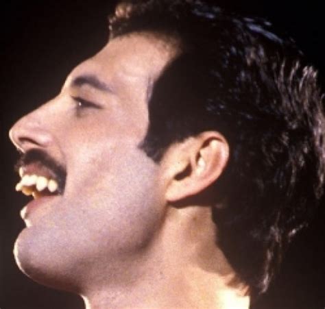 These additional incisors caused overcrowding that pushed forward his front teeth, leading to an overjet. Freddie Mercury's Teeth | HubPages