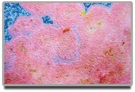 Alga) are simple organisms that typically produce their own food through you can find similar algae on shower tiles and silicone seems in moist bathrooms. Pink Algae in Swimming Pools | MyPool.Com